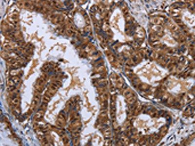 LTA4H Antibody