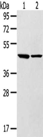 LTB4-R2 antibody