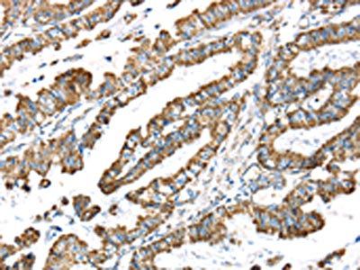 LTB4R2 Antibody