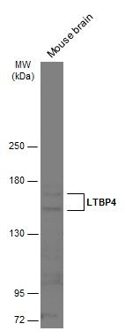 LTBP4 Rabbit Polyclonal Antibody