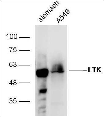 LTK Rabbit Polyclonal Antibody