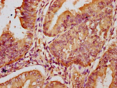 LTN1 Antibody