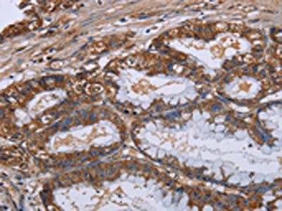 LUM Antibody