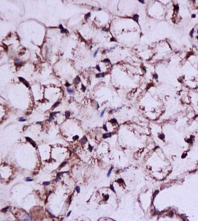 LHB Rabbit Polyclonal Antibody