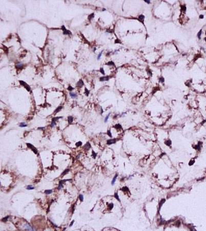 Luteinizing Hormone antibody