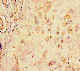 Lutropin subunit beta antibody