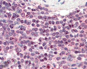 Goat anti-LXR beta / NR1H2 Antibody