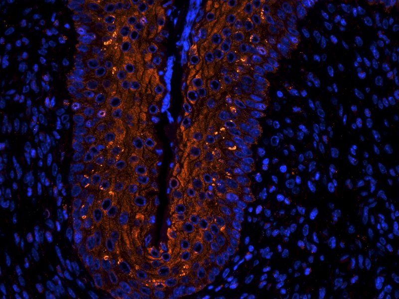 Ly-6G antibody