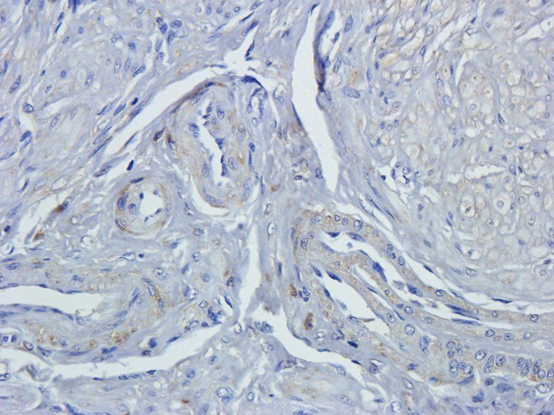 Ly-6G Rabbit Polyclonal Antibody
