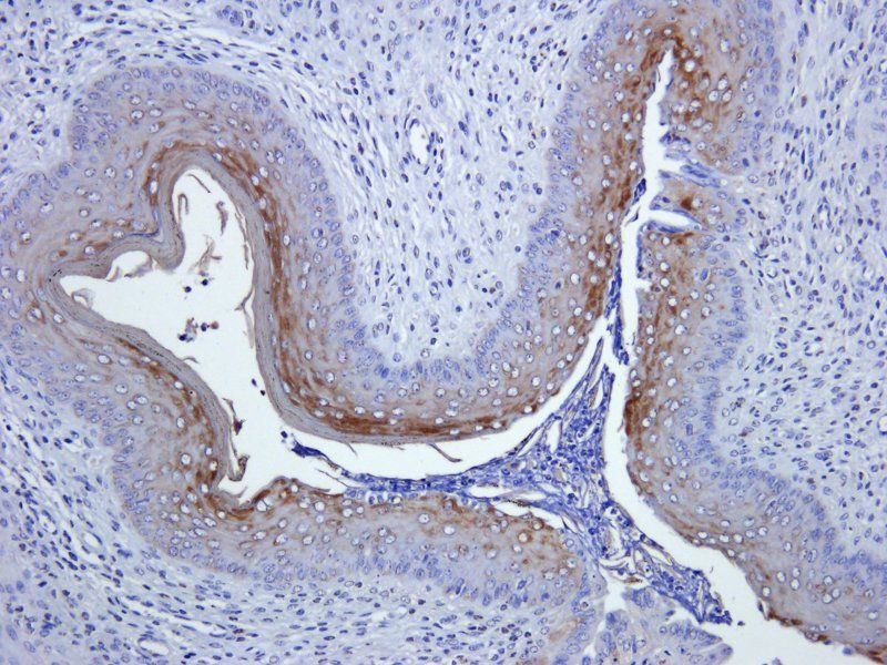 Ly-6G Rabbit Polyclonal Antibody