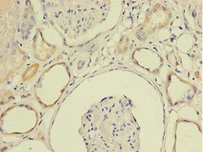 LY6E Antibody