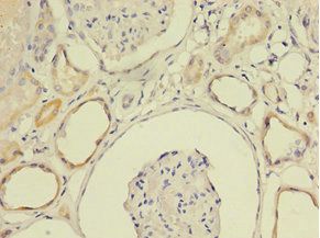 LY6E antibody