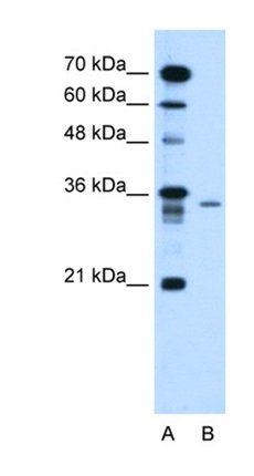 LY6G6F antibody