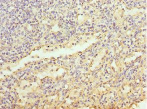 LY86 antibody