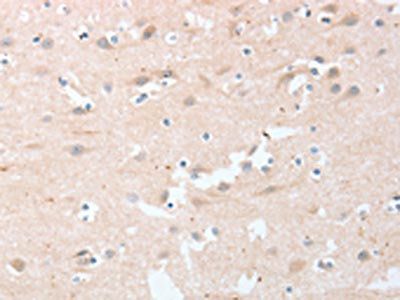 LY96 Antibody