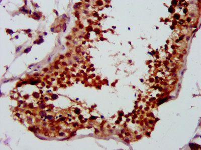 LYAR Antibody