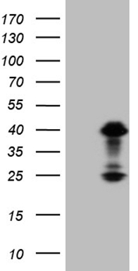 Lymphocyte Activation Gene 3 (LAG3) antibody