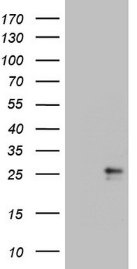 Lymphocyte Activation Gene 3 (LAG3) antibody