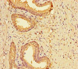 LYPD2 antibody