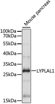 LYPLAL1 antibody