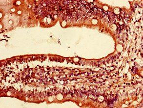 LYRM2 Antibody