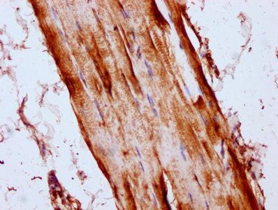 LYRM4 Antibody