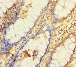BRCC3 Antibody