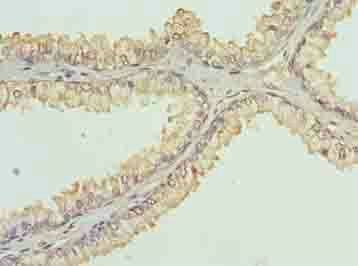 Lysine-specific demethylase 5A antibody