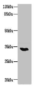 LYSMD3 antibody