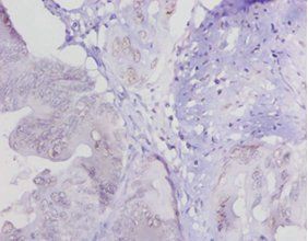 LOXL1 Antibody