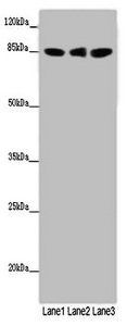 Lysyl oxidase homolog 2 antibody