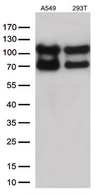 Lysyl tRNA synthetase (KARS) antibody