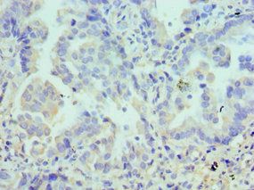 LYVE1 Antibody