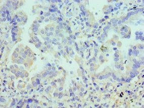 LYVE1 antibody