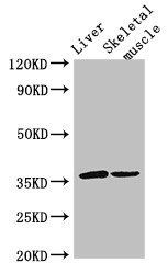 LYVE1 antibody