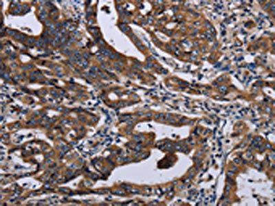LZTFL1 Antibody