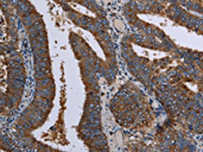 LZTFL1 Antibody