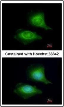 LZTFL1 antibody [N1C3]