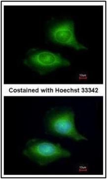 LZTFL1 antibody