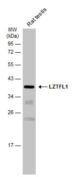LZTFL1 Rabbit Polyclonal Antibody