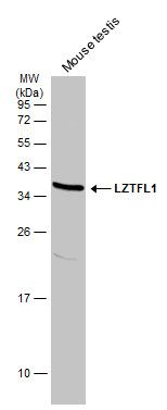 LZTFL1 Rabbit Polyclonal Antibody