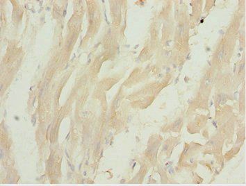 LZTR1 antibody