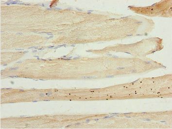 LZTR1 Antibody