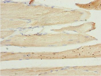 LZTR1 antibody