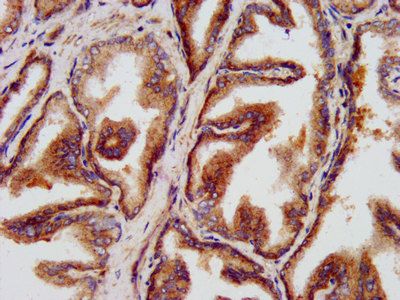 LZTS1 Antibody