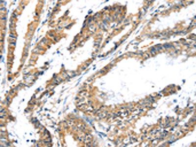 LZTS1 Antibody