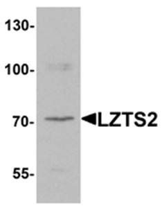 LZTS2 Antibody