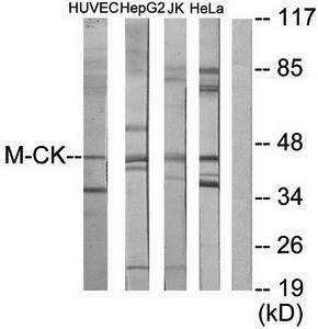 M-CK antibody