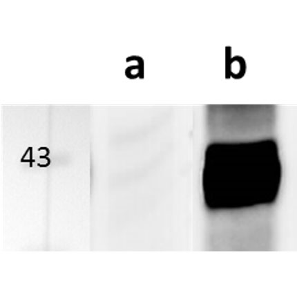 Anti-M112-113/E1 (MCMV) antibody – clone M112-113.02