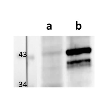 Anti-M112-113/E1 (MCMV) antibody – clone CROMA103
